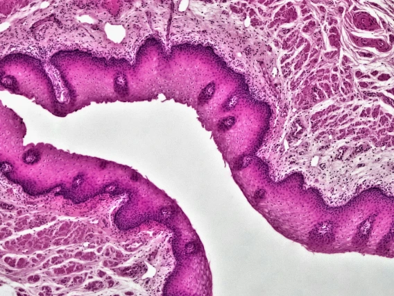 histopathology